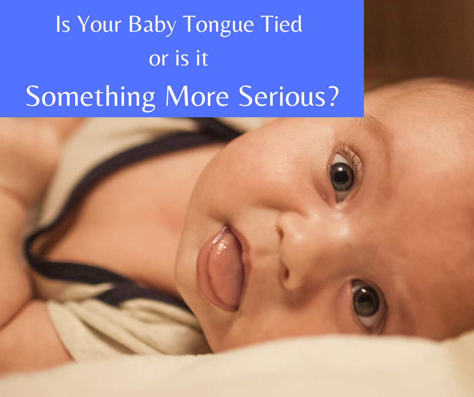 Baby-tongue-tied-fb-post